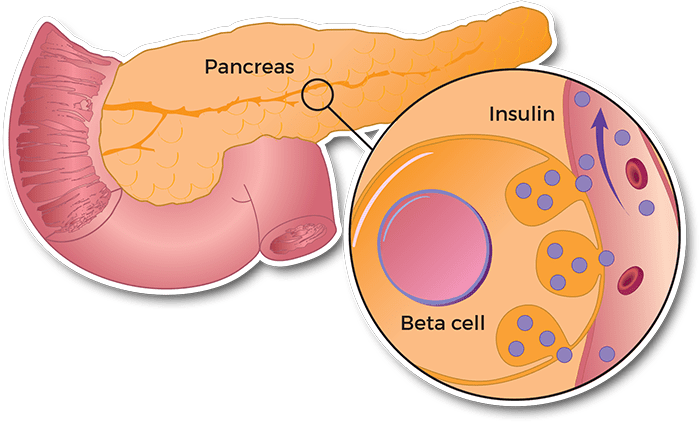 Pâncreas e o Diabetes Tipo 1